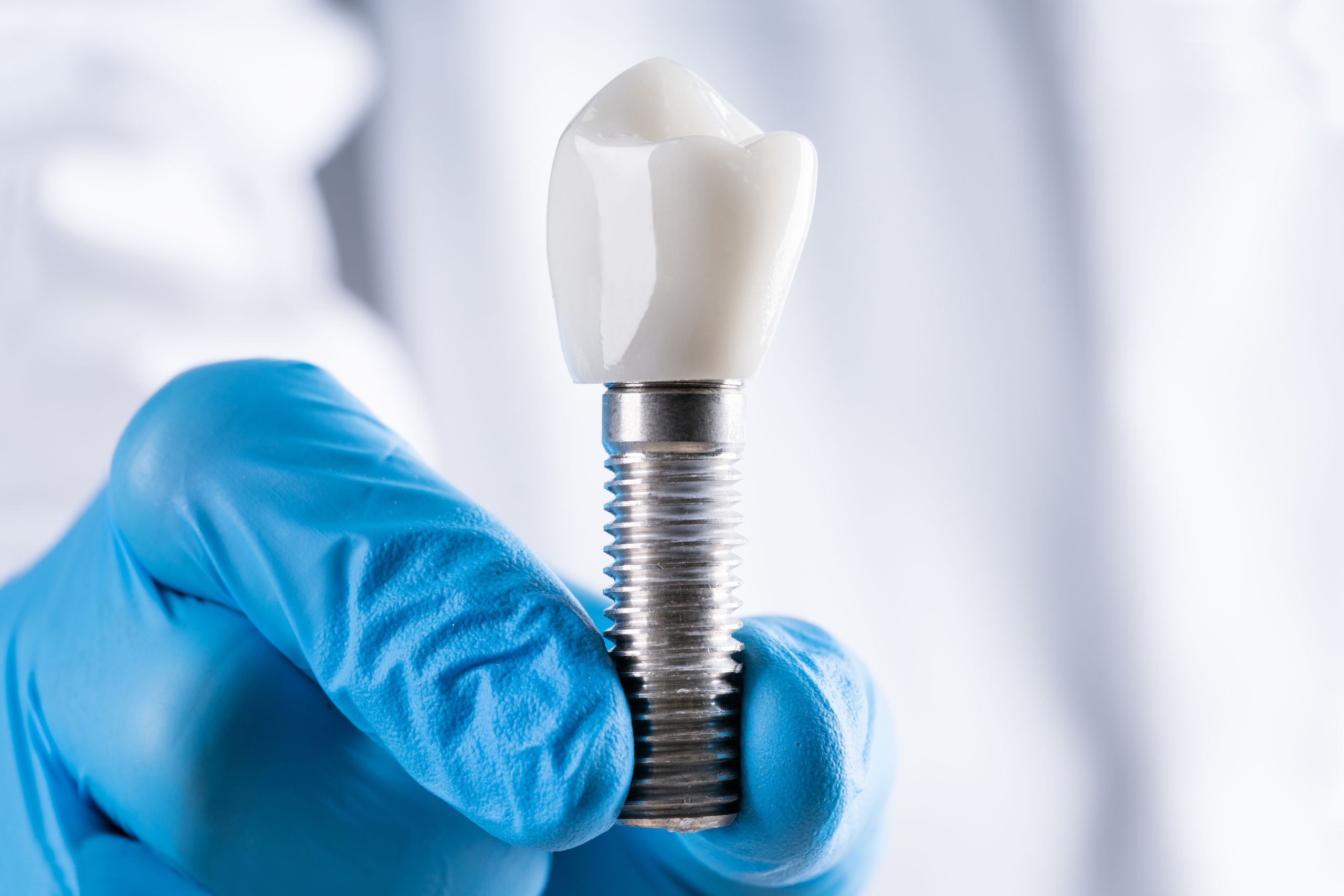 Top Reasons Why People Go Abroad For Oral Implants